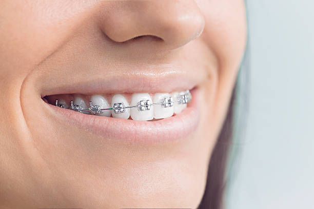 Best Root Canal Treatment  in Alameda, CA